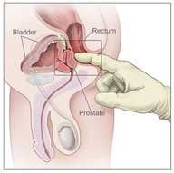 !R anatomy non-character prostate rectum // 500x498 // 127.0KB