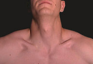 !R anatomy head neck non-character // 480x330 // 14.7KB